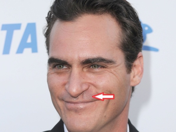 Las 15 imperfecciones que más esconden los famosos - 8. Joaquín Phoenix tiene una cicatriz